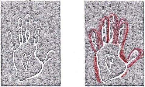 reka pacjenta biopole